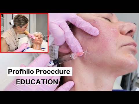 Profhilo Cosmetic Fillers