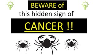 Beware of this hidden sign of Cancer! | Numb chin syndrome