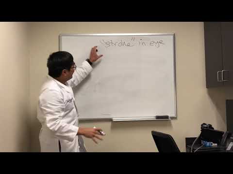 “Stroke”: NAION vs retinal artery occlusion