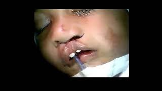 The Lateral Lip