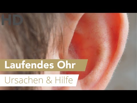 Gelenkschmerzen Beinmuskelkrämpfe in den Beinen Video Ischiasnerv zu behandeln Schmerzen im unteren Rückenhaltung Beseitigung