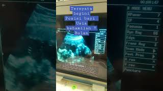 Download lagu Ternyata begini posisi bayi usia kehamilan 7 bulan#shorts #ibuhamil mp3 Download lagu Ternyata begini posisi bayi usia kehamilan 7 bulan#shorts #ibuhamil mp3