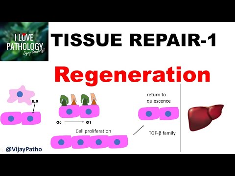 TISSUE REPAIR  Part 1: Repair - Regeneration