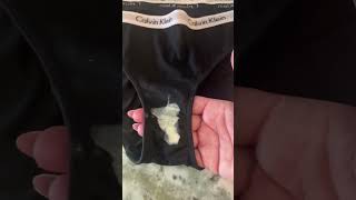 BV vs Yeast Infections - Discharge &amp; Odor #girltips #femininehygiene #femininecar #yonicare