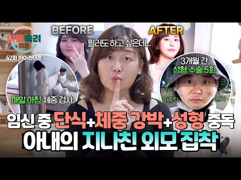 [하이라이트] 아내에겐 해도 해도 부족한 성형? 예뻐지는 게 가장 중요하다는 다이어트 아내의 욕심🎀🔥 | 이혼숙려캠프 | JTBC 250619 방송