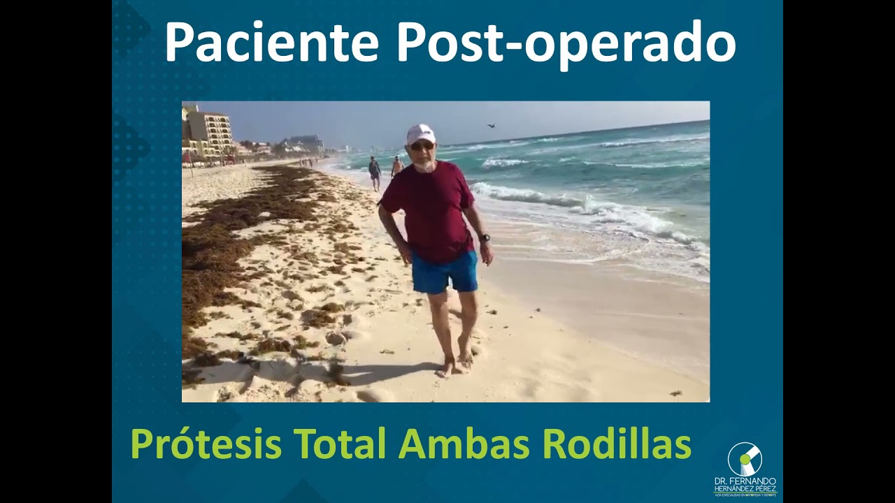 Fernando Hernández Pérez-36