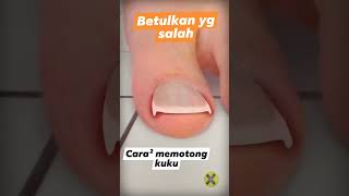 Download lagu Cara potong kuku kaki yang benar mp3 Download lagu Cara potong kuku kaki yang benar mp3