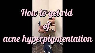 How to get rid of post inflammatory hyperpigmentation or acne scar ?