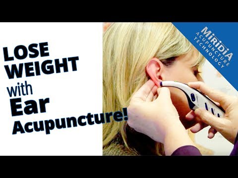 Ear acupuncture for weight loss