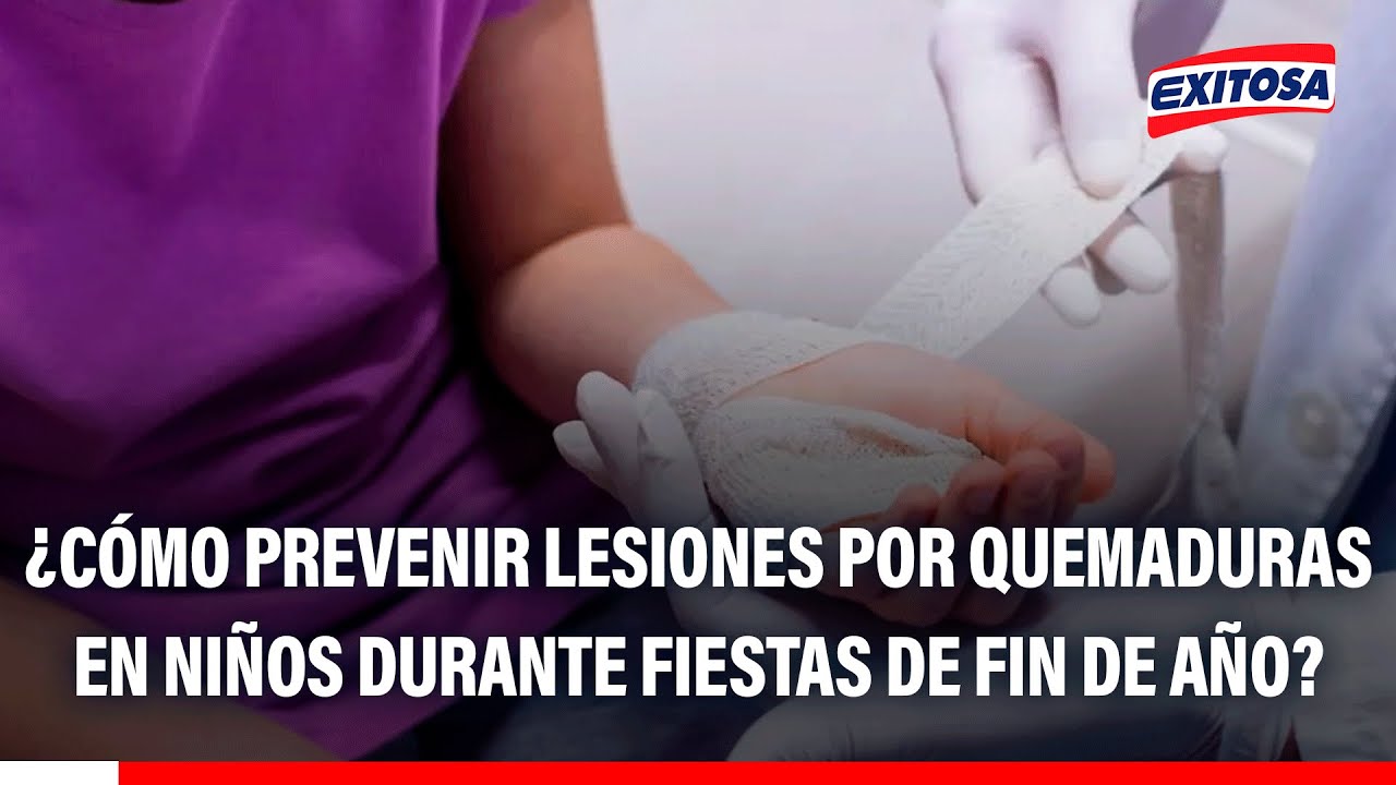 🔴🔵 ¿Cómo prevenir lesiones por quemaduras en niños durante fiestas de fin de año?