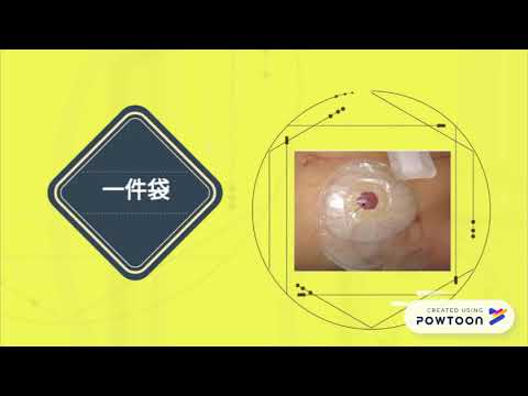 ileal conduit VERSION6 13.6.18