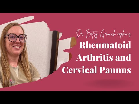 Case study 41 - Rheumatoid Arthritis and Cervical Pannus explained by board-certified neurosurgeon