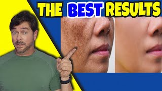 Erase Those FRUSTRATING Dark Skin Spots And Patches