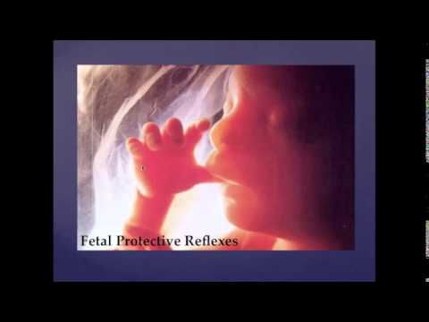 Dr  Brown's Medical Webinar Series - March 2014 - Louisa Ferrara, MS, CCC-SLP