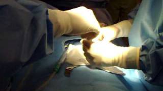 Appendectomy part 2 instruments setup