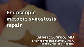 Endoscopic metopic synostosis repair