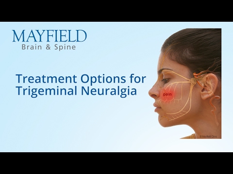 Facial Pain Treatment, Treatment Options for Trigeminal Neuralgia