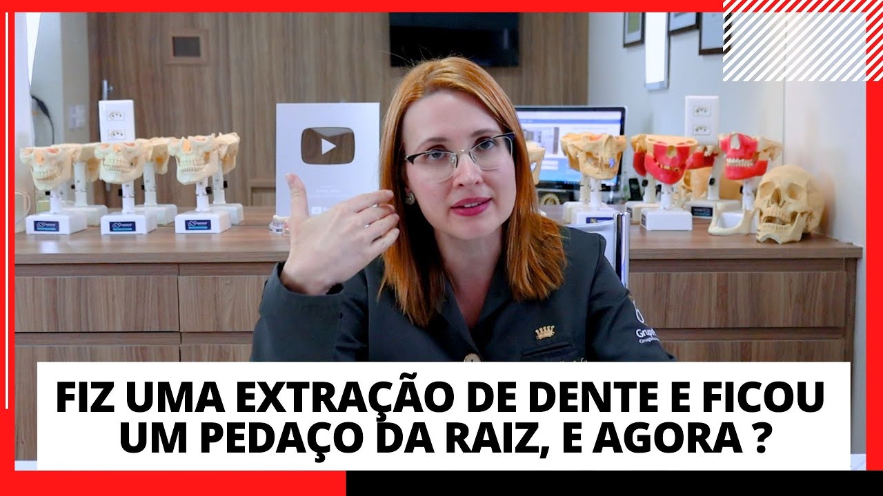 FICOU O PEDAÇO DA RAIZ DO DENTE, E AGORA ? DRA. DANIELLE SALES