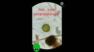 Download lagu Penampakan Virus Covid19 dibawah Mikroskop Elektron mp3