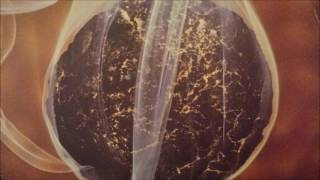 Spacer - Pseudomorph