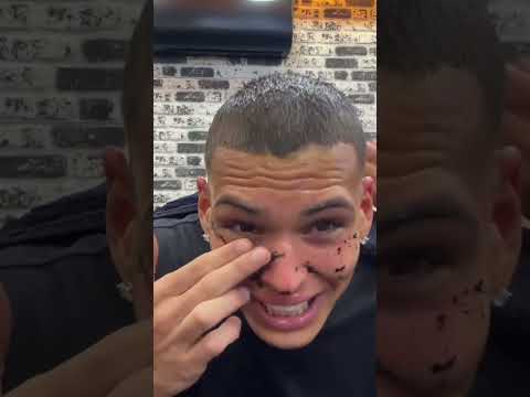 Streamer goes to a facial in Turkey but the guy accidentally puts black glue on instead ..