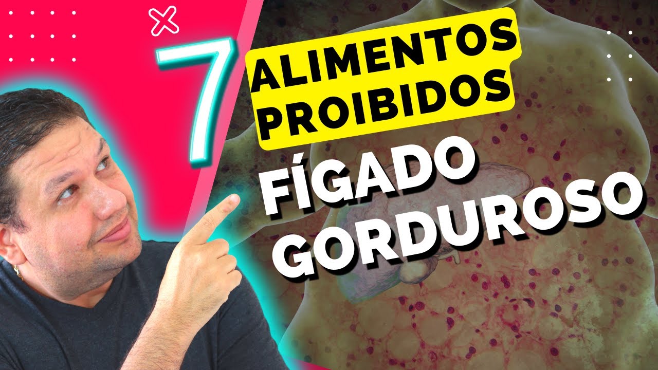 FÍGADO GORDUROSO, 7 ALIMENTOS PROIBIDOS PARA GORDURA NO FÍGADO, SINTOMAS DA ESTEATOSE HEPÁTICA.