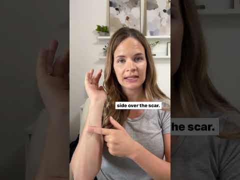 How to do Scar Massage