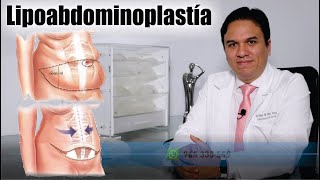 LIPOABDOMINOPLASTÍA y LIPOTRANSFERENCIA con el Dr DIEGO DIAZ 💋 ABDOMEN PERFECTO y GLUTEOS de IMPACTO