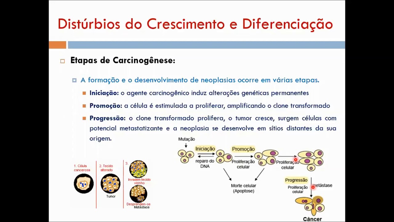 Etapas da Carcinogênese