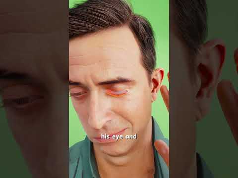 He Superglued His Sleeping Friends Eye 😳