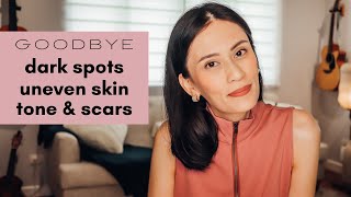 How to get rid of dark spots, uneven skin tone & scars | Dr Gaile Robredo-Vitas