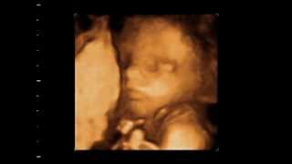 Hello Little One 3D &amp; 4D Ultrasound Ocala, FL.