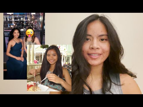 My Skin Sucks :( I'm Over It