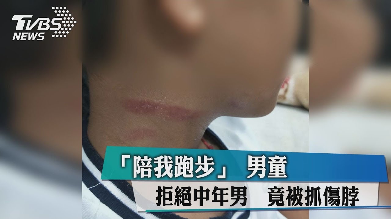 「陪我跑步」男童拒絕中年男　竟被抓傷脖