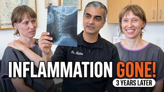 3 Years Later: Her Inflammation Is Gone After Gonstead Chiropractic