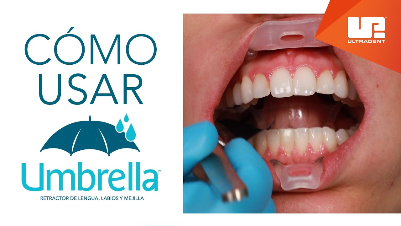 Cómo usar el retractor de lengua, labios y mejillas Umbrella™ | Step-by-Step