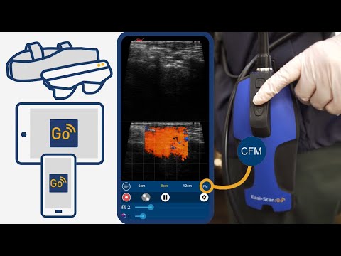 Introducing Color Doppler flow for the Easi-Scan:Go