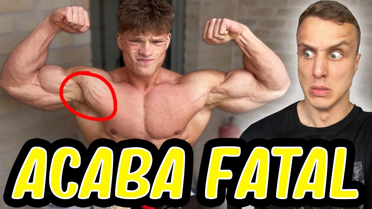 Los esteroides lo están dejando mal de la cabeza *culturista open de 21 años*