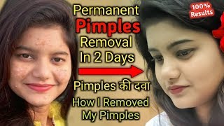 Remove Pimples Using Ayurvedic Natural Medicine in 2 Days