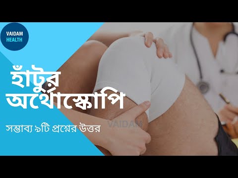 হাঁটু আর্থ্রস্কোপি- প্রায়শই জিজ্ঞাসিত প্রশ্ন