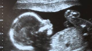 His Daughter - Molly Kate Kestner