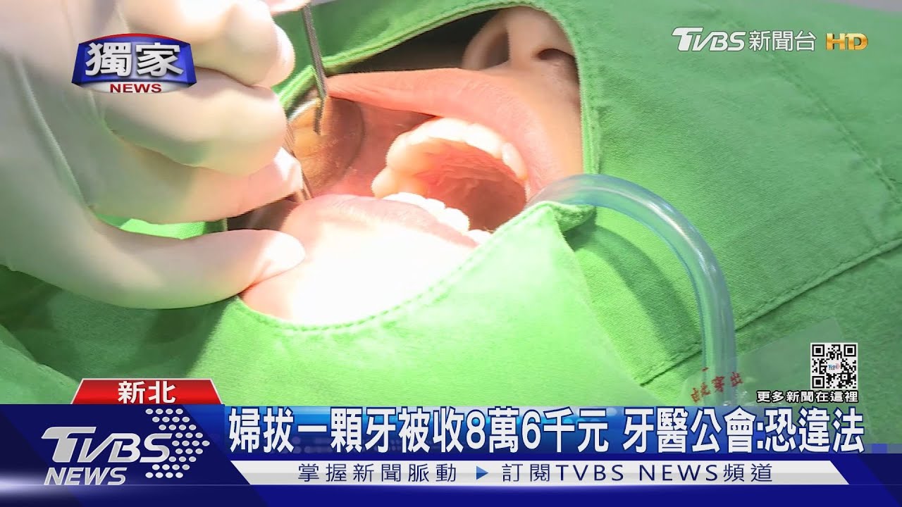 婦拔一顆牙被收8萬6千元　牙醫公會：恐違法