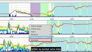 ActStudio Tutorial 10 - Menu de Ações da Pontuação do Sono