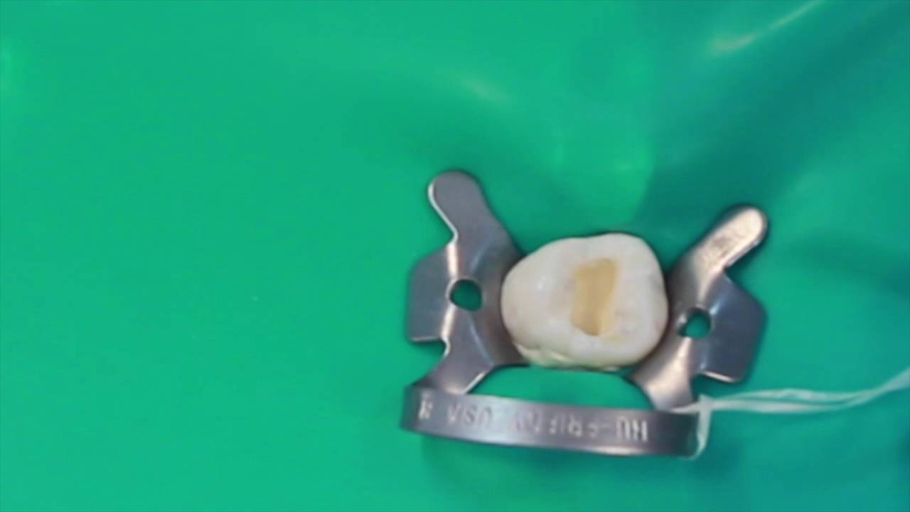 Vidrio Ionómero Cuarta Generación Base Cavitaria