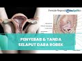 Sering Disebut Tak Perawan Ketahui Ini Penyebab Dan Tanda Selaput Dara Wanita Robek