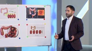 Առաջին օգնություն. Կոլոռեկտալ քաղցկեղ