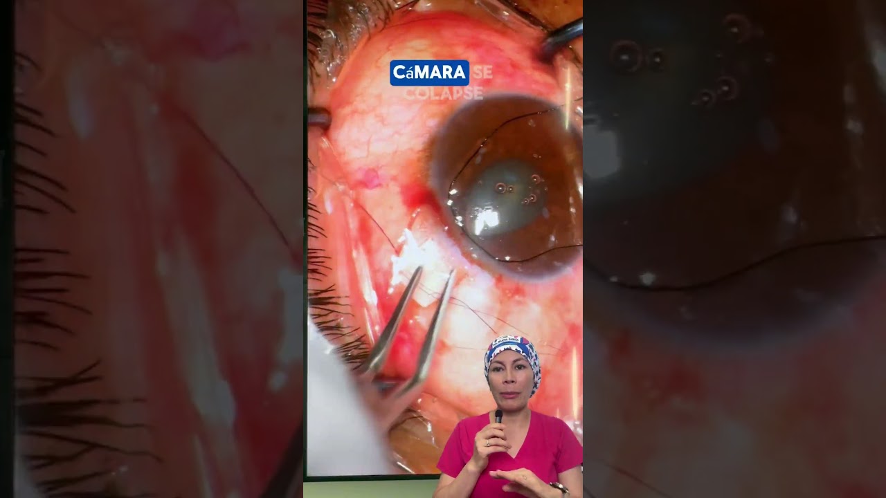 Miguel Ángel Pinedo Saboya-42