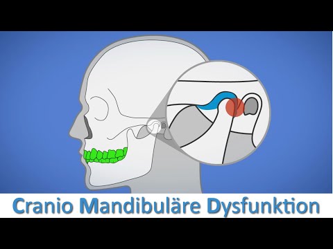 CMD - Welchen Einfluss hat die Kiefer- und Zahnstellung auf unseren Körper?
