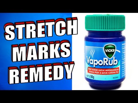 How to Use Vicks VapoRub to Get Rid of Accumulated Belly Fat and Cellulite, Eliminate Stretch Marks and Have Firmer Skin How to Use Vicks VapoRub to Get Rid of Accumulated Belly Fat and Cellulite, Eliminate Stretch Marks and Have Firmer Skin