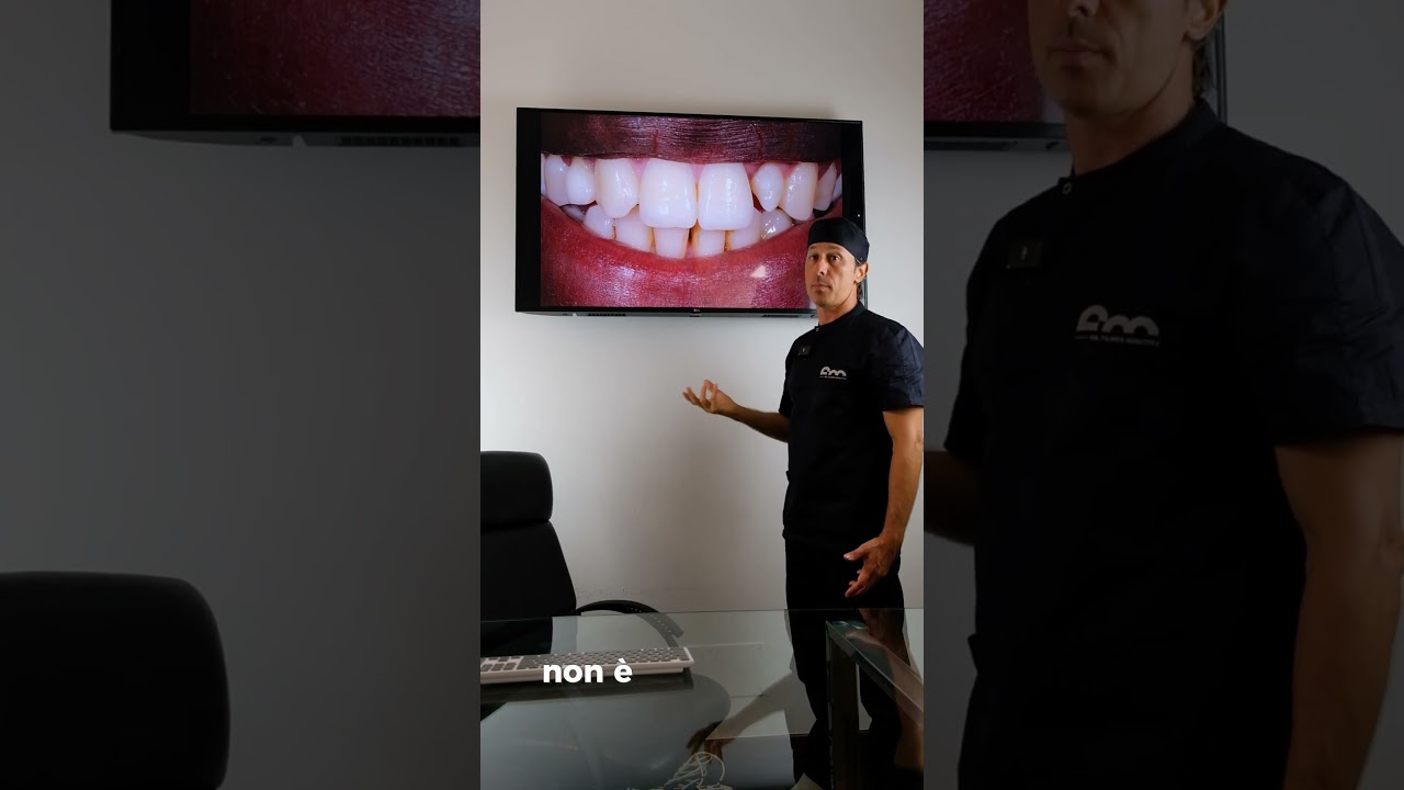 Ricostruzione dentale